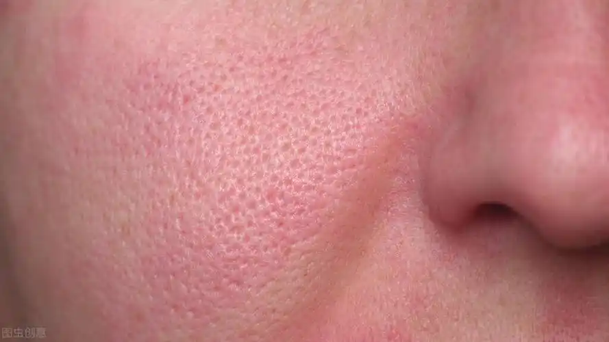 重度毛孔粗大怎么办?别慌,还有救 | 说明书网