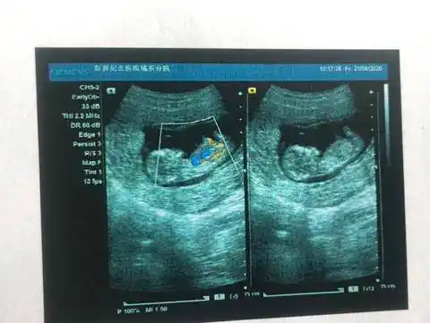 可以看出男孩女孩吗?12周