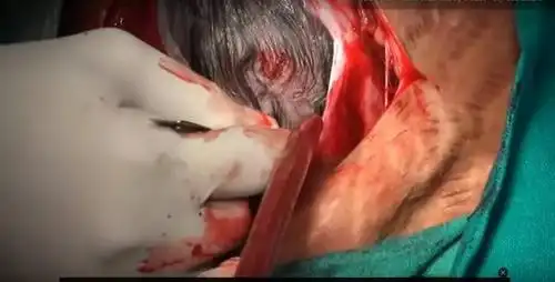 图解生孩子全过程看完就知道妈妈的伟大