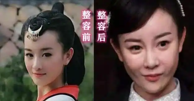 娱乐圈的整容脸看看他们上镜有离谱硅胶感十足像发面馒头