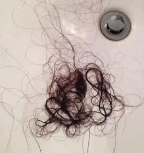 产后掉头发,一抓一把,5个问题了解产后脱发,教新妈妈如何预防