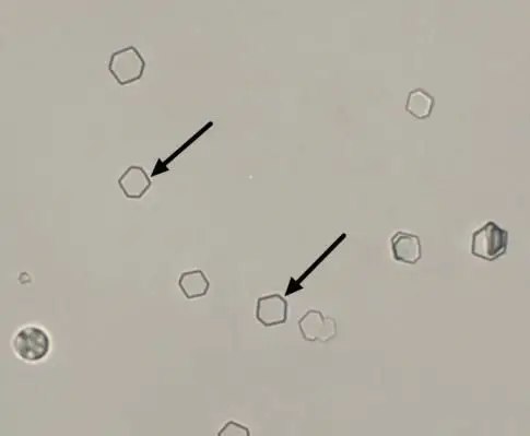 189答案:胱氨酸结晶