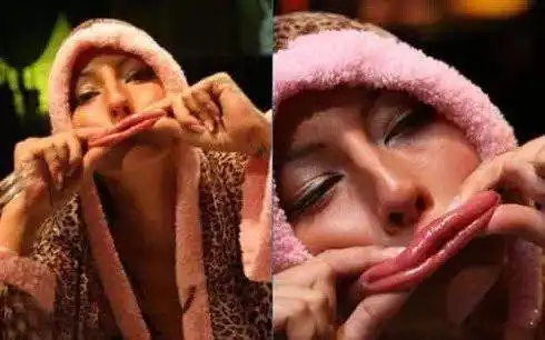 图为:世界上腿最多的女人.她有四条腿,是世界上唯一成年的四条腿女人.