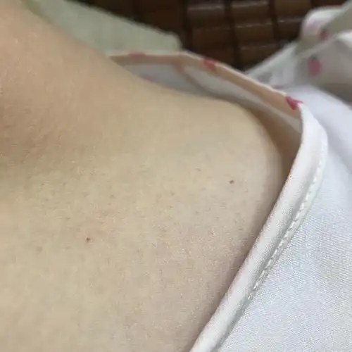 请问身上长了些像朱砂红点事什么东西?不痛不痒的