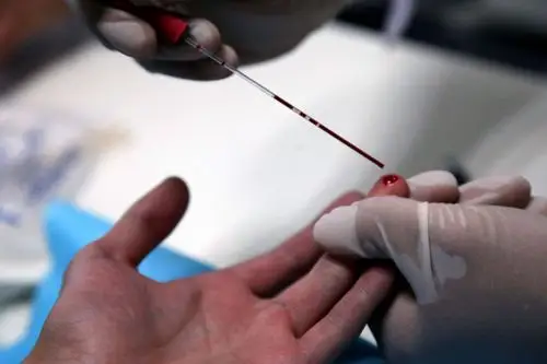 滴血验癌靠谱吗东南大学回应媒体报道有夸大成分