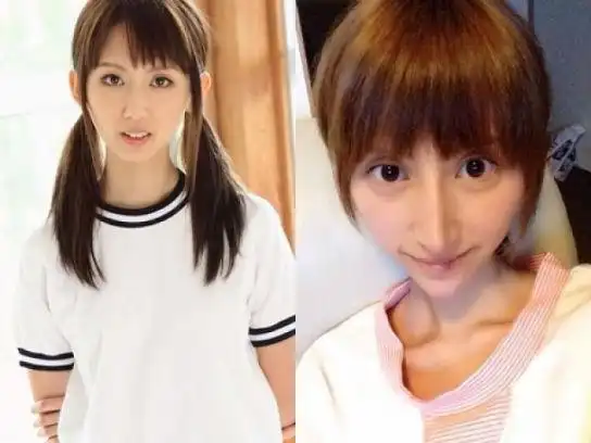 日本女星整容成大眼锥子脸 被讽酷似外星人(图)