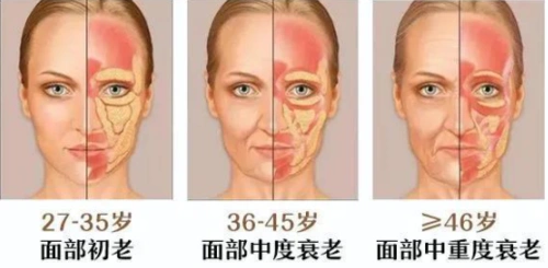 面部松弛下垂是衰老的表现吗,怎么才能恢复紧致肌肤_皮肤松弛_介绍