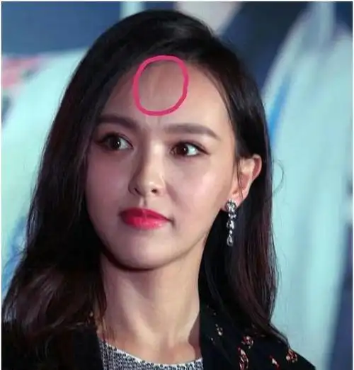 被发际线困扰的女明星们:唐嫣还算好的,程潇就很"危险"了
