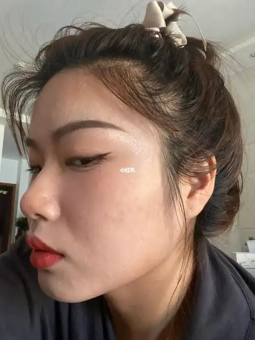 这是正常人的皮肤状态吗