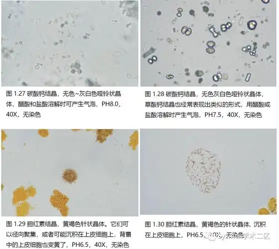 尿液结晶形态汇总