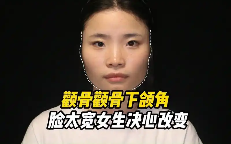 轮廓案例|短方脸妹妹决心改变自己 改个脸型换个气质