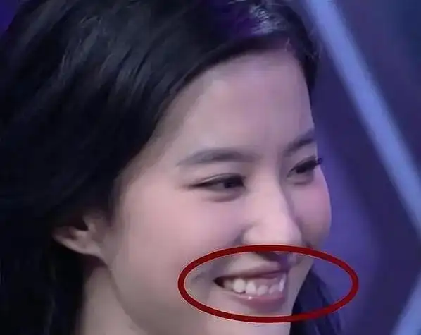 刘亦菲笑起来露出牙龈的样子真的不好看