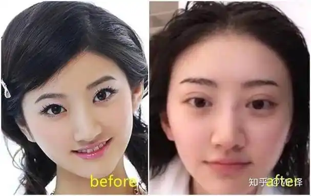 最全的明星整容前后对比照