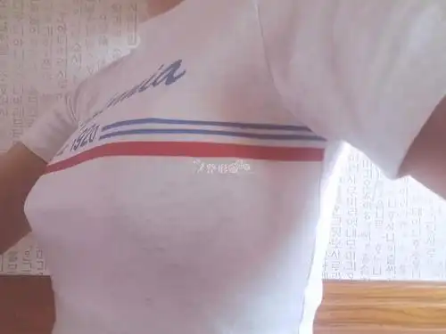 赛彬胸11天,"脱衣"我也有"胸"了_韩国整形日记_韩国整容前后对比照片