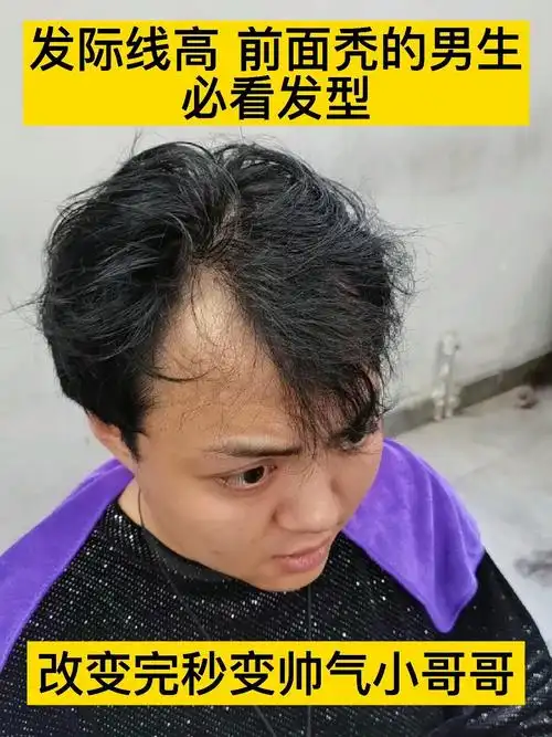 适合男生发际线高 前面秃的发型