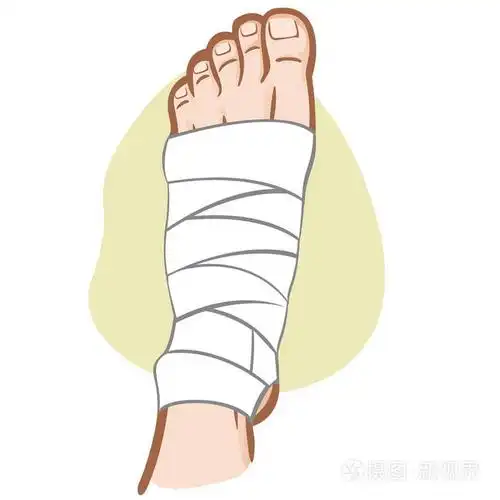 说明冷杉援助人高加索, 绷带脚, 顶部的看法.