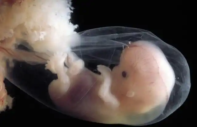 关于胚胎发育,看看吧