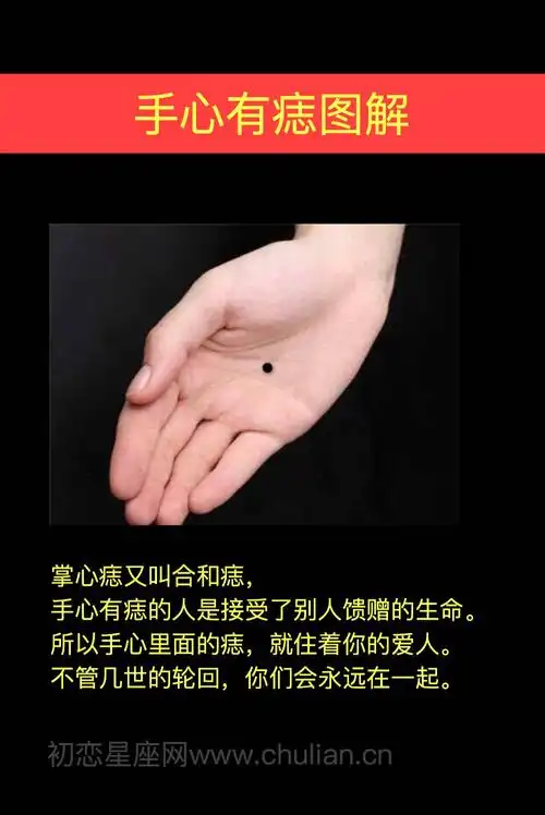 手指有痣运势 手指有痣运势如何