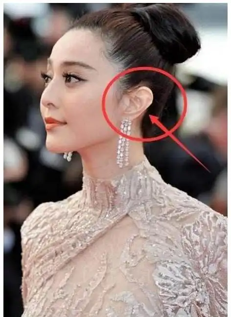 space耳轮长痣耳轮上长有痣的人,聪明伶俐,有着极强的逻辑思维能力