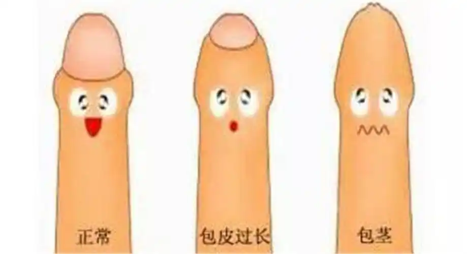 包茎对比图片