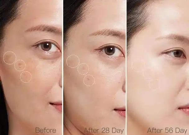 哪种护肤品美白补水祛斑效果好,不吹不黑的淡斑护肤品