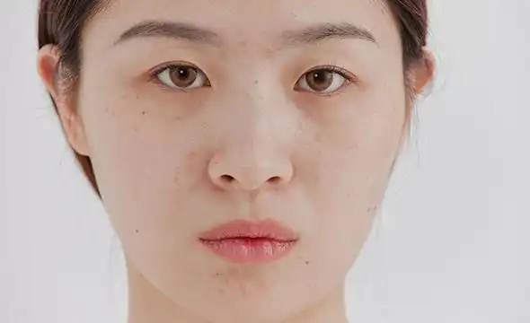 ai数据集产品_ai数据采集标注_数据堂_60_4,788张人脸肤质缺陷采集