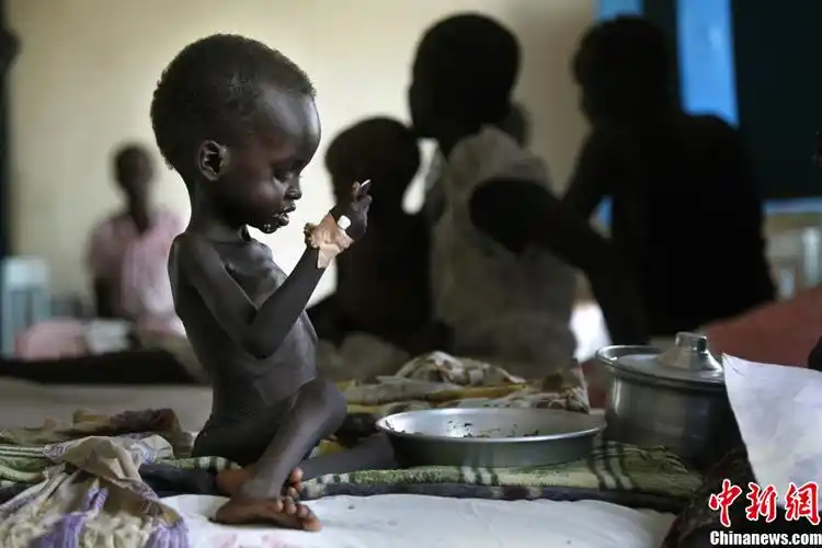 4月8日,苏丹,一名儿童正在医院的病床上吃东西.