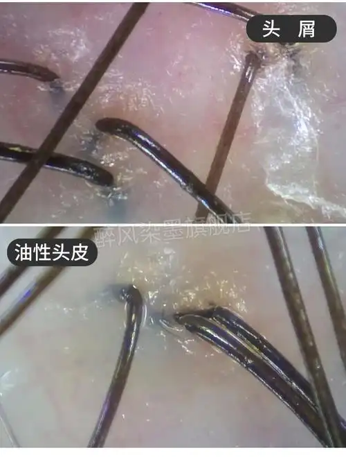 皮肤仪器无线wifi头皮头发毛囊检测仪皮肤毛发仪器理发店高清放大器双