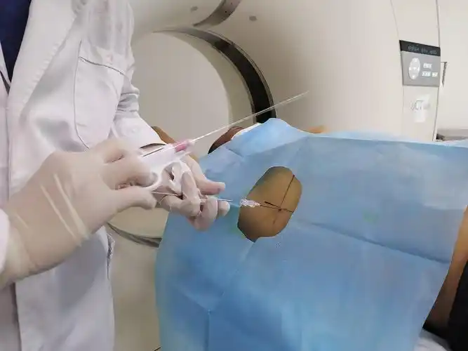 濉溪县中医院完成首例ct引导下经皮肺穿刺活检术