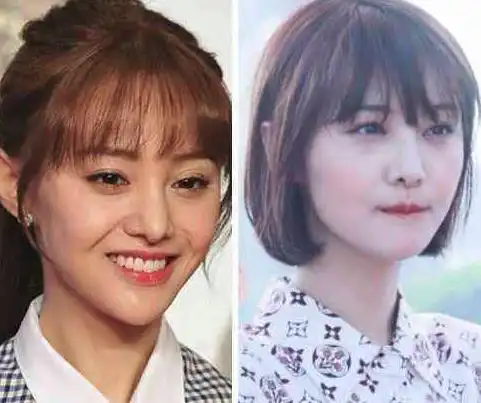 郑爽的鼻子新变化(郑爽以前现在的对比照)