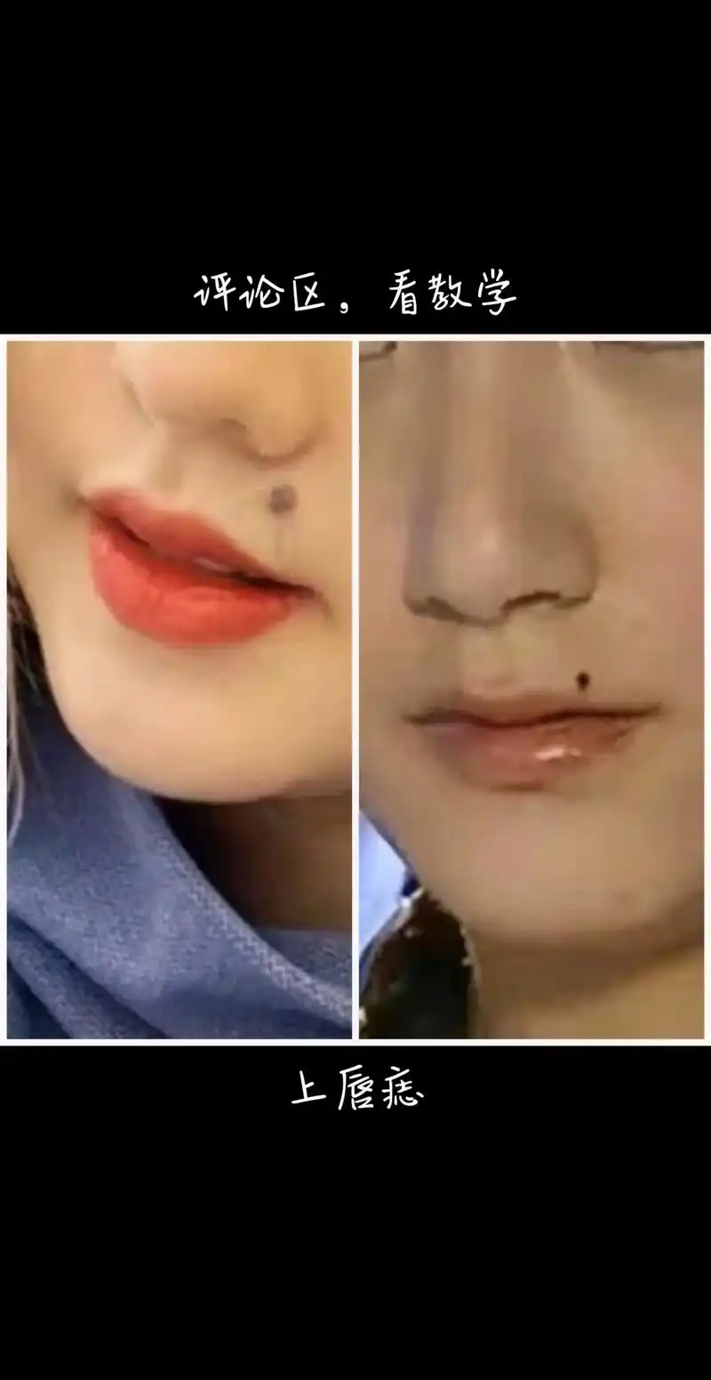 无论男女,上唇有痣皆为水难之相,到水边游泳或乘船只之时,务必特别