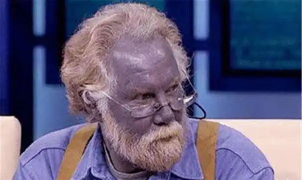 美国现"罕见"蓝种人,隐居6千米高山上百年,皮肤血液均为蓝色