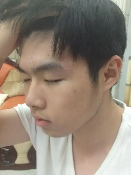 这样算蒜头鼻吗