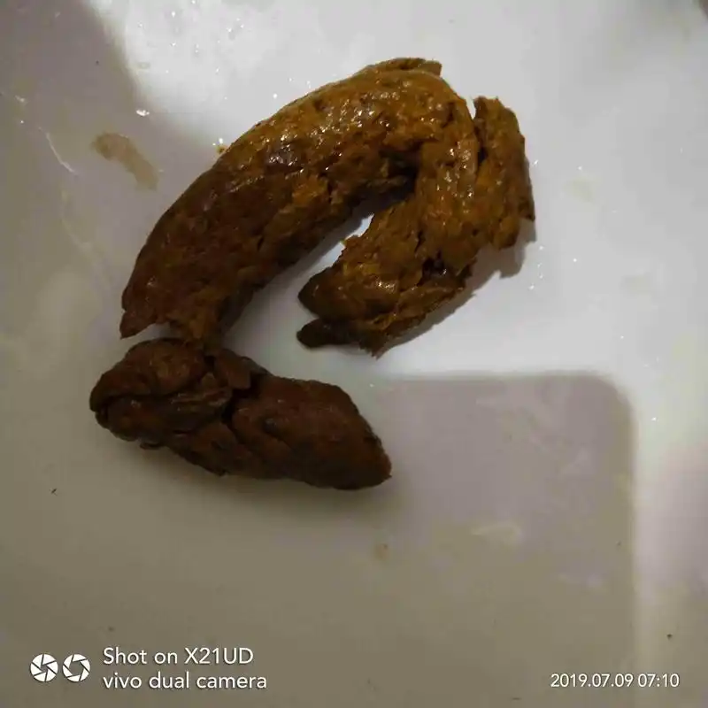 这种大便正常吗?