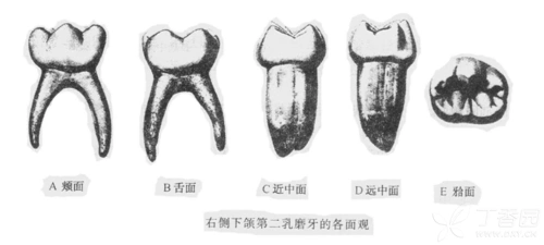 虽然说下颌第二乳磨牙和下颌第一恒磨牙形态相似,乍一看容易复眄