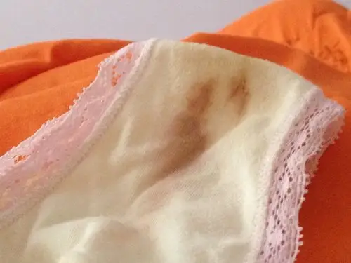 流了这么多血能保住吗