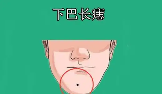 身体4颗"富"痣,男人旺财,女人旺家,只要一个,少奋斗十年!