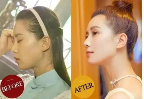 把这些明星照片给他看,扁脑袋丑得一目了然