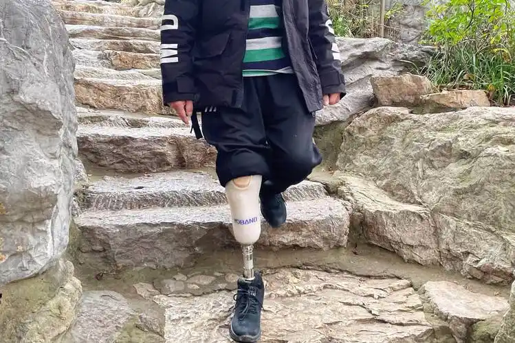 半足截肢患者如何选择假肢_理想_小腿_部分