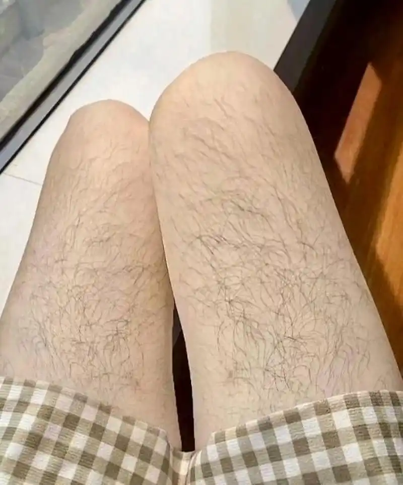 自从八岁那年开始,身上的腿毛跟春风过后的野草一样,用了脱毛膏也不