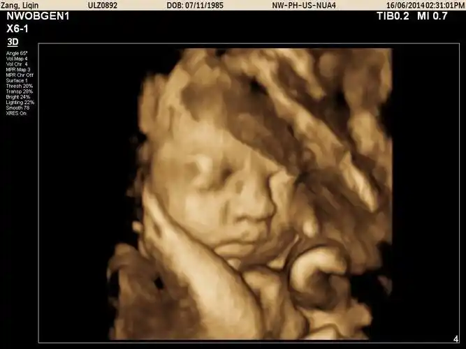 为什么胎儿四维照丑相b超医生告诉你真相原因是这三点