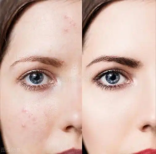 中年男女皮肤油腻满脸油光怎么办一文读懂