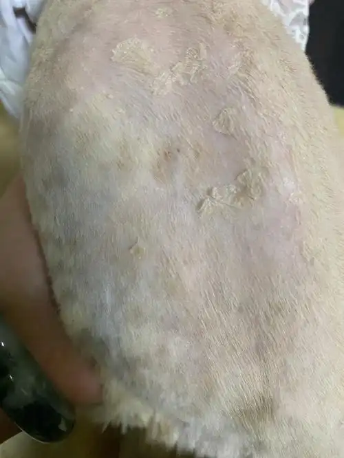 皮肤病不要命但