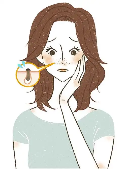 患鼻子毛孔病的女人插画下载