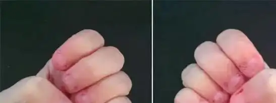 王一博啃指甲被偷拍,孩子这个很常见的行为,却吓坏了家长