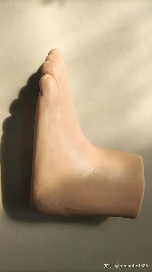 一例半足截肢患者制作硅胶拉链假肢的制作流程介绍