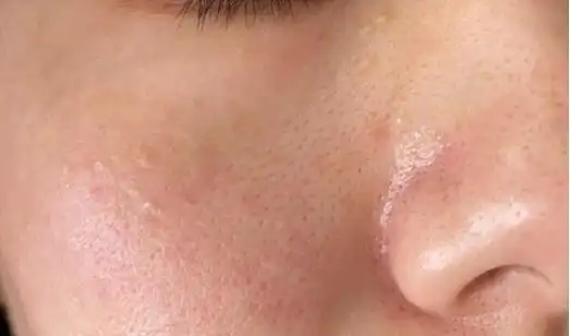 如果你皮肤油腻粗糙,一定不能错过这款氨基酸洗面奶,尤其是男生