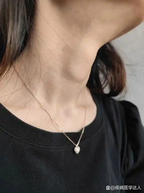 女生长喉结 各位大佬们,有谁知道我这个正常吗,从小到大都这样,一个