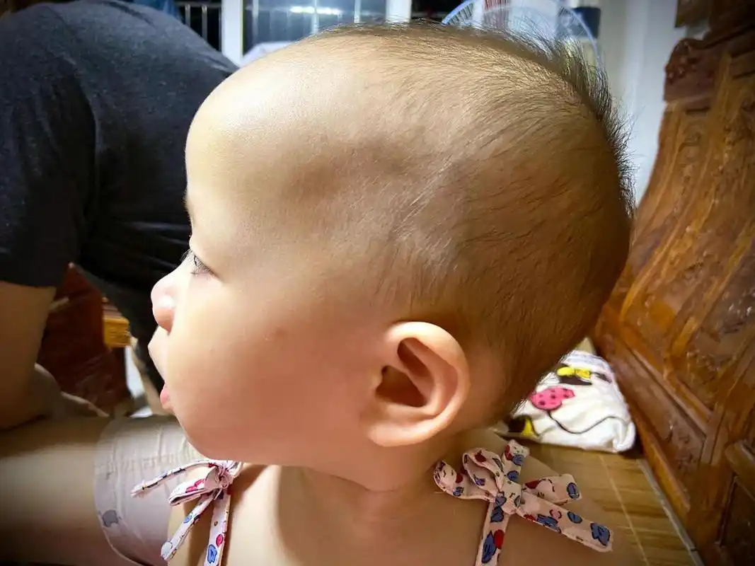 女宝宝舟状菱形头没那么可怕 最近研究了一些明星头型,发现舟状菱形头