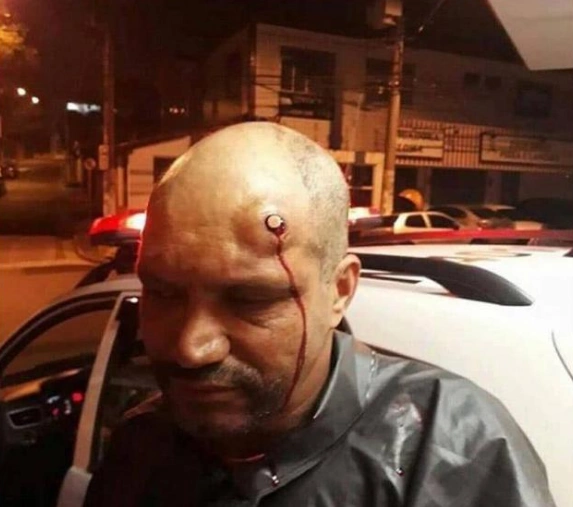 这些人运气实在爆棚!子弹击中脑袋若无其事,炮弹命中只是轻伤